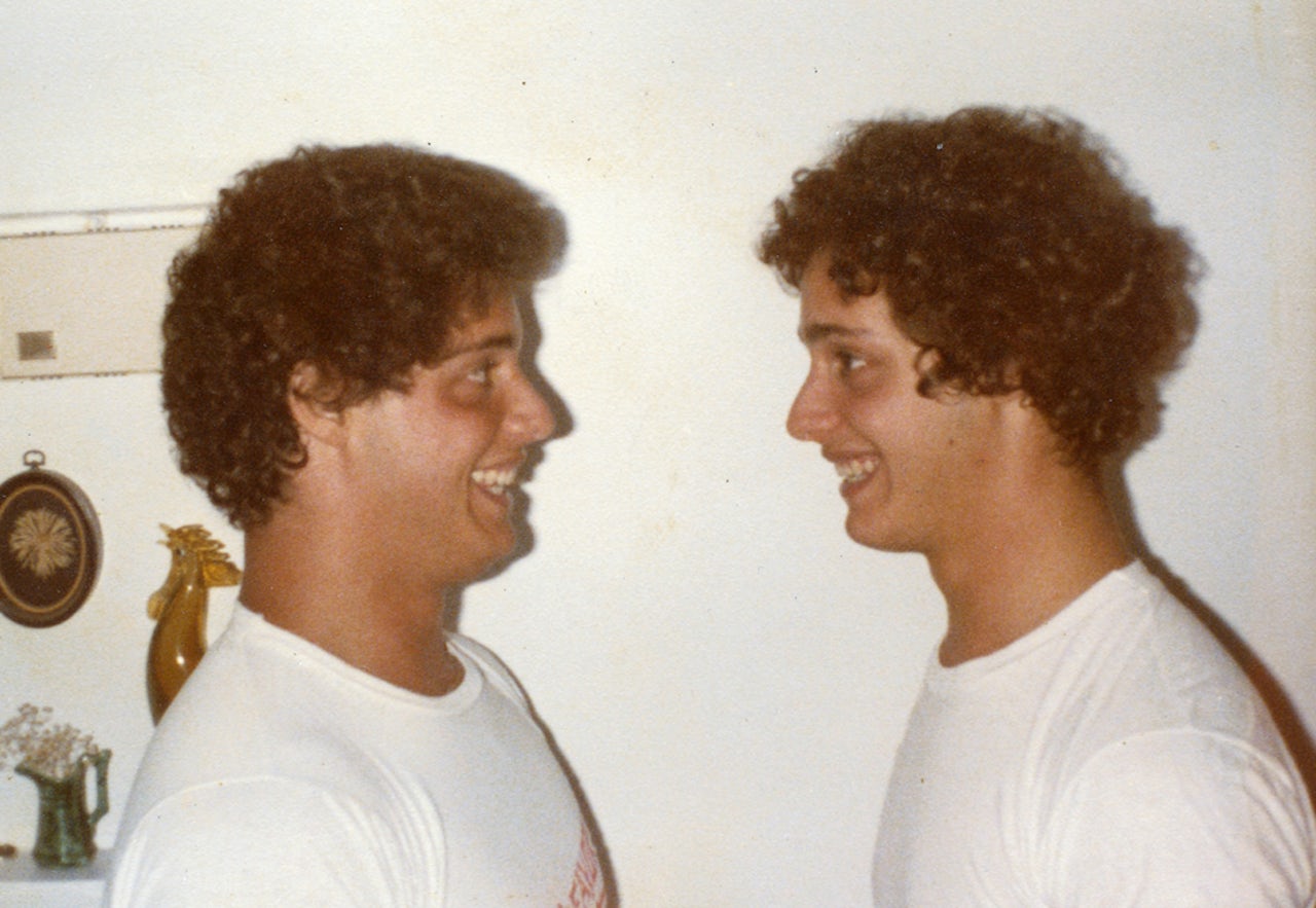 The Sticky Business Of Separating Twins The Outline