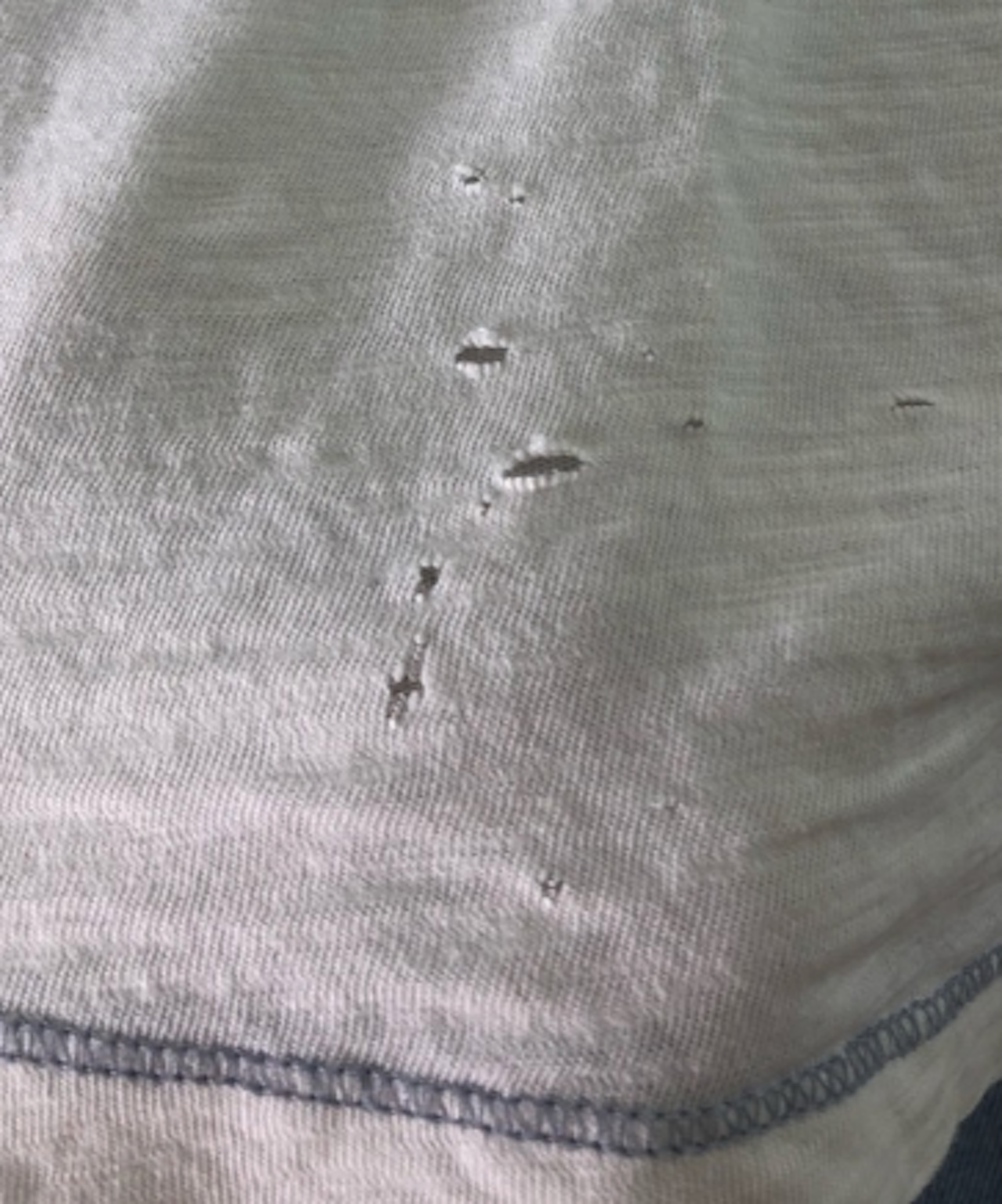 What Causes Holes in Clothes?